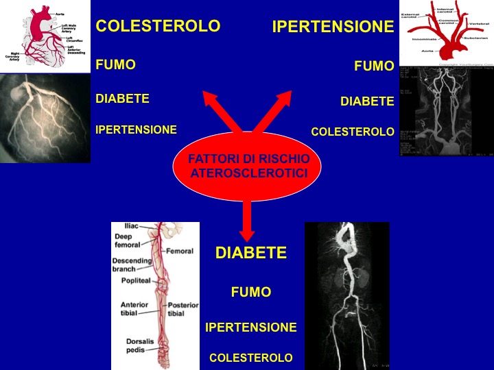 fattori di rischio